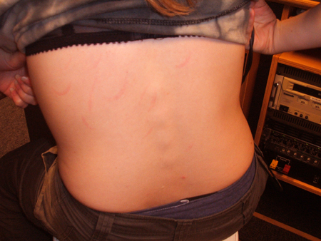 ein erschreckendes bild!