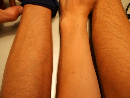 ..vor allem die arme!