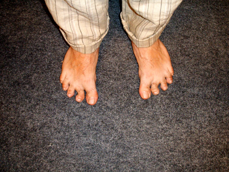 auch springhuhn moderiert barfuß!